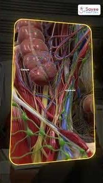 Appendix Pain: Don’t Ignore the Signs