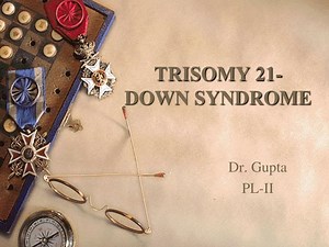 TRISOMY 21- DOWN SYNDROME - SlideServe