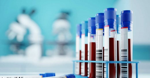 GGT : quel est le taux normal de Gamma GT et quand s’inquiéter ?