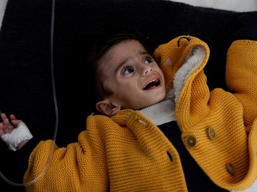 Starvation: Anatomy of ‘a very cruel, slow death’