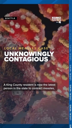 Public Health - Seattle & King County confirmed a new measles case in a King County adult who was on the same flight as a person previously diagnosed with measles in a case announced Oct. 17. Health officials believe the individual was exposed during that flight. According to Public Health, the person later visited several public locations while contagious, including Toyota of Renton, Valley Medical Center, YangGuoFu Malatang restaurant, and the Disney on Ice event at ShoWare Center in Kent. Fol