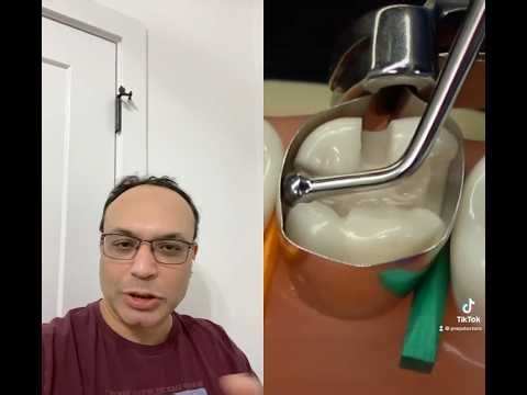 Tofflemire Matrix Band Placement Mistake (Burnishing Tip) #foreigntraineddentist