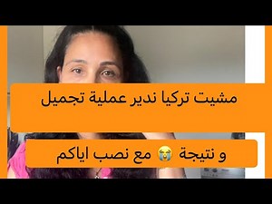 ها هي نتيجة عملية تجميل 😔 الله ياخد فيكم الحق 😒