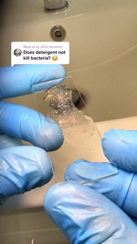 Pink mold under the microscope!