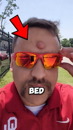 Grew a Forehead Ball_! 😱 | Hidden Cell