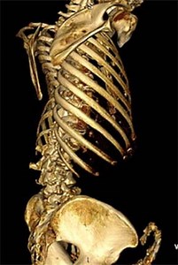 “Coming to Know: an artist investigates her own unusual anatomy” Works by Laura Ferguson