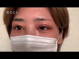 眼瞼下垂手術 抜糸
