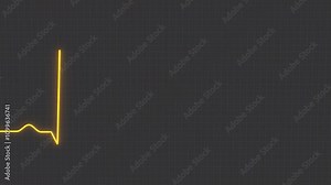 ECG, electrocardiogram of a healthy person, normal heart rhythm. Looped Seamless 3D Animation.