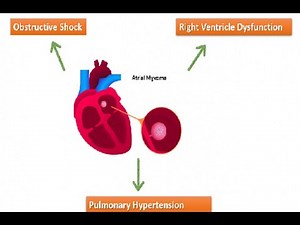 Obstructive Shock; Definition and characteristics