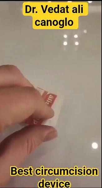 Alisklamp device #Alisklamp #circumcision #childhealth