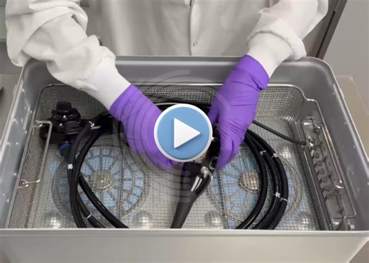 SteroScope: Faster, Safer Sterilization for Endoscopes | Ideate Medical posted on the topic | LinkedIn