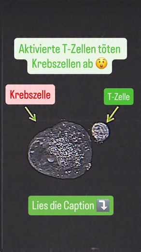Giovanni Barbato 🌱 Prävention statt Medikation | Dein Körper kämpft jetzt gerade. Jede Sekunde. Ohne Alarm. Ohne Schmerz. Ohne, dass du es merkst. Dieses Video zeigt eine T-Zelle, wie sie... | Instagram