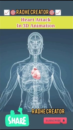 🧑‍⚕️👉Heart Attack in 3D Animation#heartattack #animation #anatomy#medical#gk #shortvideo #shorts