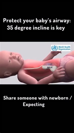 Science | cosmos on Instagram: "Protect Your Baby’s Airway 👶💨 After feeding, keeping your newborn at a 35° incline helps prevent regurgitated milk from entering the airway — reducing the risk of choking and aspiration. Flat-lying position increases reflux because gas pushes milk upward. A slight incline supports safer digestion and easier burping. Tip: Hold your baby upright for 20–30 minutes after feeding. 🔹 Inspired by WHO infant care recommendations 🔸 Share this with new or expecting pare