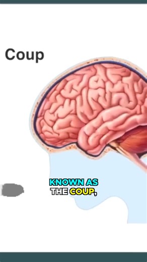 A concussion is a form of closed head injury that occurs from an impact to the skull. #concussion #closedheadinjuries #closedheadinjury #falls | Dr. Chris