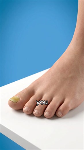 Thick Toenails: Causes, Signs, and When to Treat