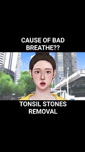 886K views · 8.8K reactions | [Animation] Cause of bad breath !Tonsil stones removal. | Chishiki | Facebook