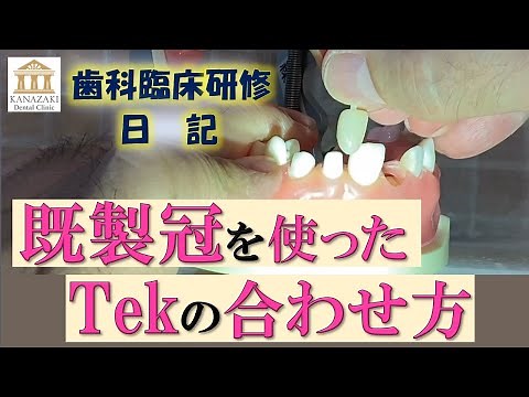 歯科臨床研修日記 既製冠を使ったTekの合わせ方