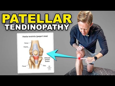 Patellar Tendon Rehab Exercises