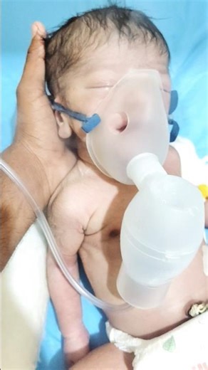 Tiny Newborn Nebulization Cry 😭🍼 | Heart Touching Preemie Video 💞#tinybaby #trendingbaby #viral#love