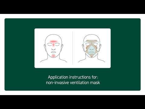 Mepilex® Lite fore a application