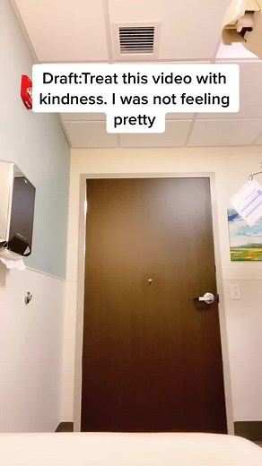 Angioedema causes people to stare at me. #model#angiodema#bday