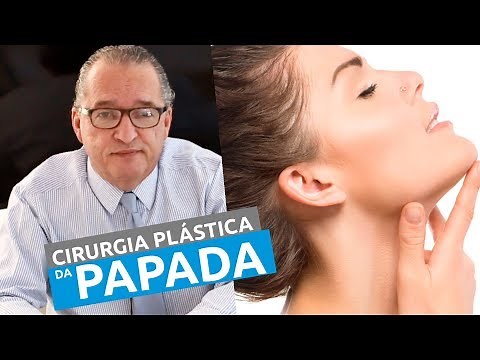 CIRURGIA PLÁSTICA PARA TIRAR A PAPADA DO PESCOÇO . MÉDICO DR LECY EXPLICA