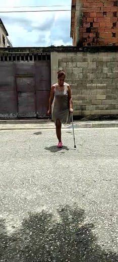 #protesis #amputada #amputeegirl #muletas #oneleg #amputee #amputeelife ##model #prosthetic