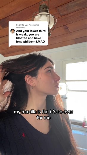 Exploring Facial Features: Flat Maxilla in 50 Languages