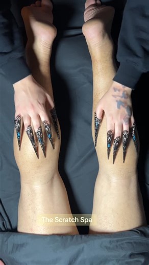 The Scratch Spa | Who died and appointed anyone else to decide what “normal” healing looks like? Stop letting other people’s opinions dictate your recovery.... | Instagram