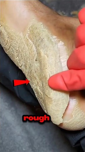 These rough spots actually save your skin 👀 #shorts #medicalfacts