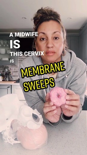 Membrane Sweep for Inducing Labour: A Comprehensive Guide