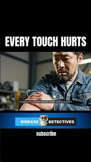 What If a Simple Touch Could Tear Your Skin? | Butterfly Skin #diseases #skin #skindiseases