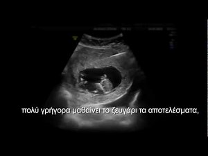 Βιοψία Τροφοβλάστης