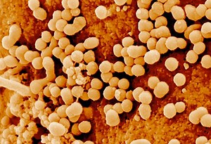 Sida et VIH · Inserm, La science pour la santé