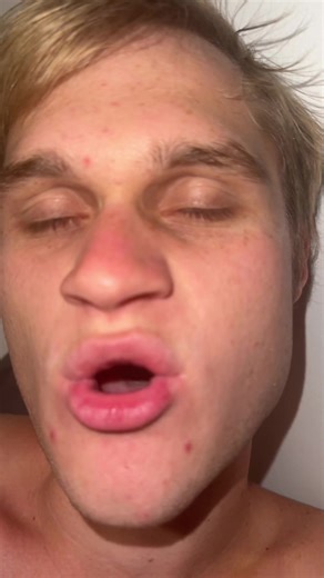 Bring back normal facts