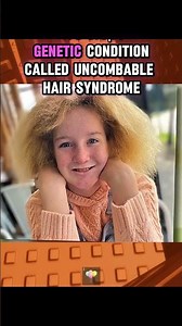 This Is What Rare Genetics Look Like