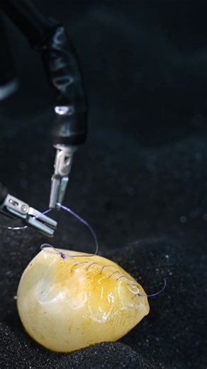 Can a surgical robot stitch an egg? 🥚 That’s how precise the Toumai® Surgical Robot is. With ultra-stable control and sub-millimeter precision, Toumai® handles even the most delicate tasks — from stitching tissue to suturing a fragile egg. #robot #surgical | MicroPort MedBot