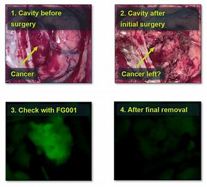 Fluorescent guidance to surgical oncologists - FluoGuide A/S