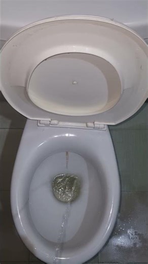 POV: When You Finally Reach the Toilet 😌🚽 #washroom #experiment #urinate #asmr