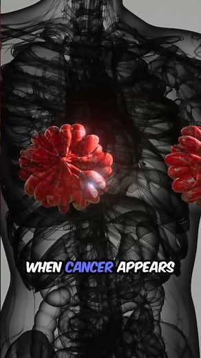 Mastectomy