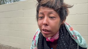 Ariel is 22, homeless & addicted. She burned her face, neck & hair most likely by falling asleep high with a torch/lighter. Watch the full interview at Lost in Phoenix on YouTube https://youtu.be/_c-Z-jX-GgI?si=qfWDWxB2AWYNEwt6 | Arturo Castro