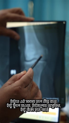 হাঁটুতে এই সমস্যা হলে তীব্র ব্যথা, হাঁটু ফুলে যাওয়া, হাঁটাচলায় অসুবিধা, হাঁটু বাঁকা হতে পারে