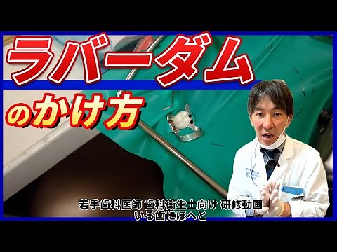 ラバーダム防湿、準備とかけ方【根管治療】