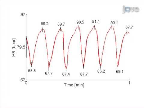 Quantitative Autonomic Testing