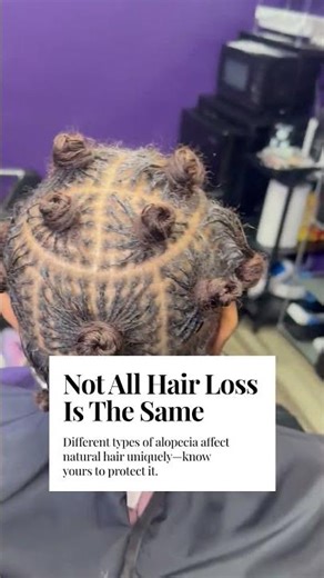 Understanding Alopecia in African American Hair
