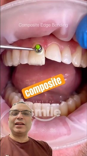 Broken Tooth? Watch This Fix! 😬➡️😁 #dentist #youtubeshorts #dentistry