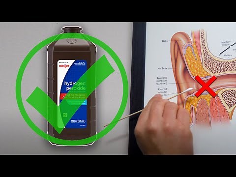 How to Safely Remove Ear Wax At Home