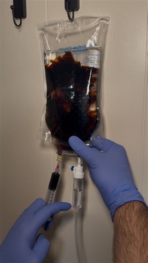 Immunity Center on Instagram: "Restore your energy from within, this infusion helps replenish low iron levels, support red blood cell production, and combat fatigue so you can feel stronger and more balanced. #ironiv #ironivdrip #irondeficiency #hydration #healthylifestyle #healthandwellness #ivtherapy #iv #immunity #immunitycenter #wellness #trending #trendy #healthiswealth #ivdrip"