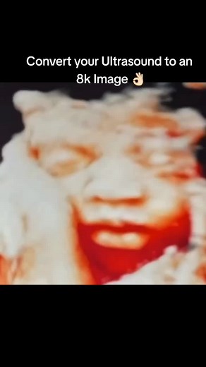 Enhance Your Ultrasound Images with 8K Technology